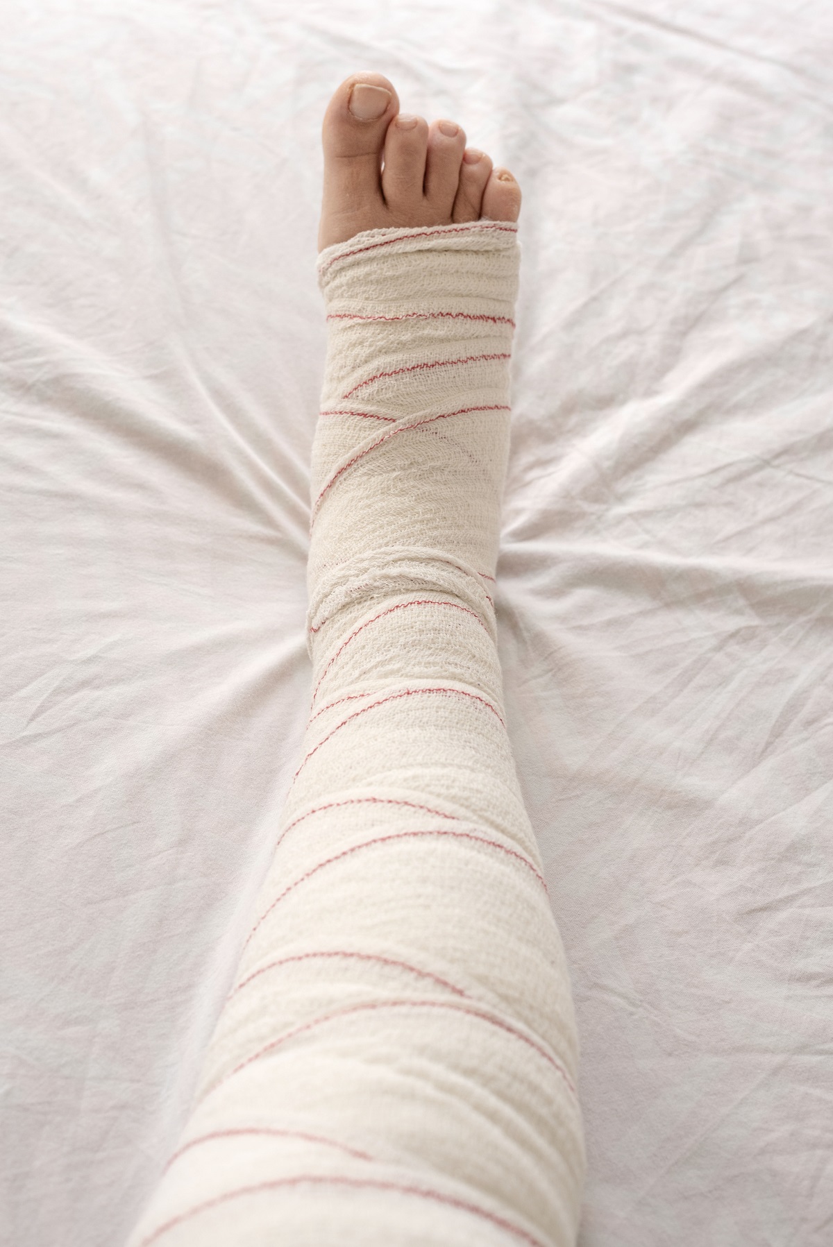 A leg in a bandage