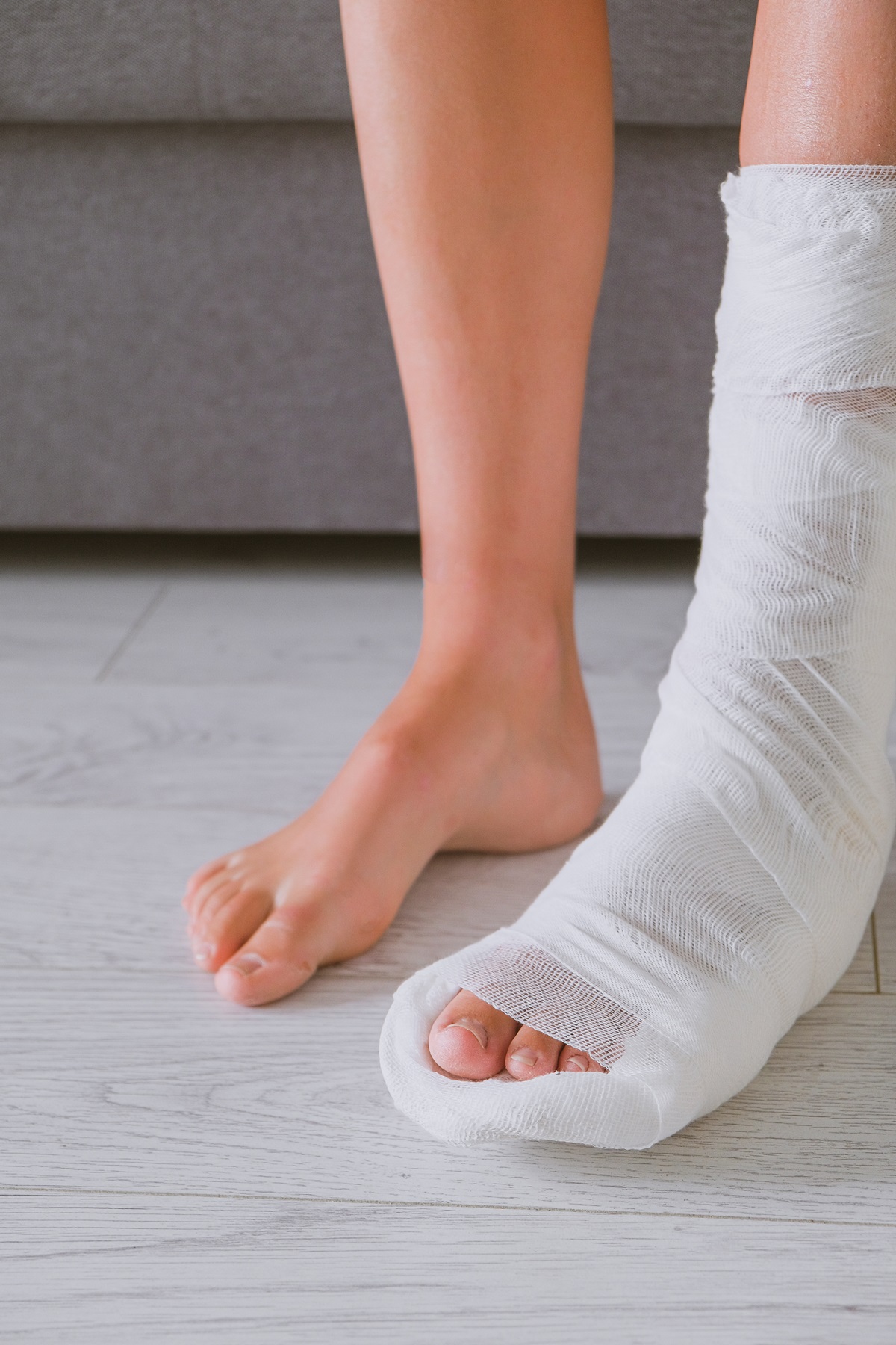 An injured leg in a cast